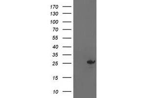 Western Blotting (WB) image for anti-Adenylate Kinase 4 (AK4) antibody (ABIN1496526) (AK4 抗体)