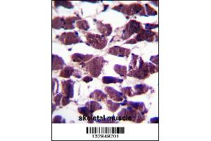 LRIG2 Antibody immunohistochemistry analysis in formalin fixed and paraffin embedded human skeletal muscle followed by peroxidase conjugation of the secondary antibody and DAB staining. (LRIG2 抗体  (C-Term))