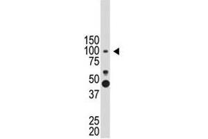 Image no. 1 for anti-Prospero Homeobox 1 (PROX1) (N-Term) antibody (ABIN357416) (PROX1 抗体  (N-Term))