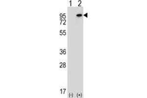 Western blot analysis of WHSC1L1 (arrow) using rabbit polyclonal WHSC1L1 Antibody (N-term) . (WHSC1L1 抗体  (N-Term))