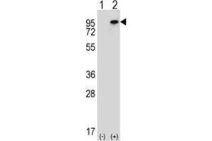 Western blot analysis of WHSC1L1 (arrow) using rabbit polyclonal WHSC1L1 Antibody (N-term) . (WHSC1L1 抗体  (N-Term))