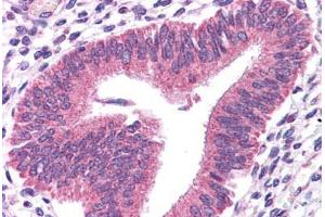 Immunohistochemistry (Formalin-fixed Paraffin-embedded Sections) (IHC (fp)) image for anti-Signal Transducer and Activator of Transcription 3 (Acute-Phase Response Factor) (STAT3) (N-Term) antibody (ABIN6745716)