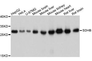 Western blot analysis of extracts of various cell lines, using SDHB antibody. (SDHB 抗体  (AA 29-280))