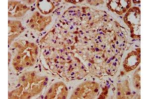 IHC image of ABIN7143295 diluted at 1:500 and staining in paraffin-embedded human kidney tissue performed on a Leica BondTM system.