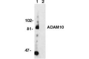 Image no. 1 for anti-ADAM Metallopeptidase Domain 10 (ADAM10) (AA 732-748) antibody (ABIN201912) (ADAM10 抗体  (AA 732-748))