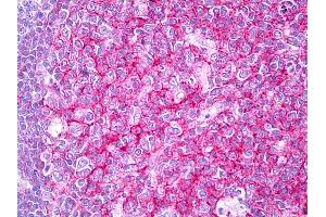 Anti-CD81 antibody IHC of human tonsil, germinal center. (CD81 抗体)