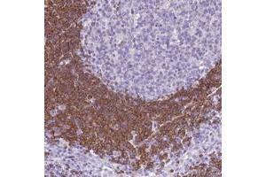 Immunohistochemical staining of human lymph node with BANK1 polyclonal antibody  shows strong cytoplasmic positivity in lymphoid cells outside reaction centra.