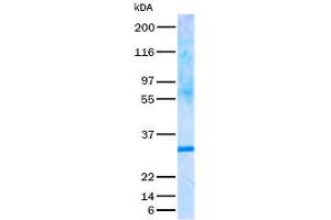 Validation with Western Blot (TIGAR Protein (TAT tag))