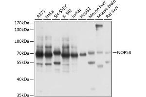 Western blot analysis of extracts of various cell lines, using NOP58 antibody  at 1:1000 dilution. (NOP58 抗体  (AA 360-529))