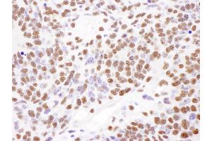 Immunohistochemistry (IHC) image for anti-Poly A Binding Protein Nuclear 1 (PABPN1) (AA 1-50) antibody (ABIN7454922) (PABPN1 抗体  (AA 1-50))