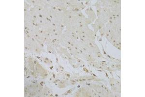 Immunohistochemistry of paraffin-embedded human stomach using TSC22D3 Antibody.