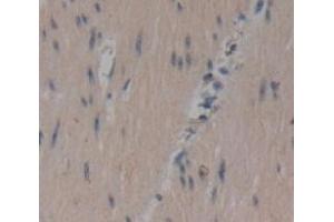IHC-P analysis of Human Tissue, with DAB staining. (CCDC80 抗体  (AA 635-906))