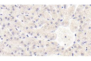 Detection of SIRT3 in Human Liver Tissue using Monoclonal Antibody to Sirtuin 3 (SIRT3) (SIRT3 抗体  (AA 126-399))