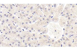 Detection of SIRT3 in Human Liver Tissue using Monoclonal Antibody to Sirtuin 3 (SIRT3)