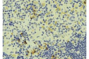 Immunohistochemistry (IHC) image for anti-Coronin, Actin Binding Protein, 1A (CORO1A) (Internal Region) antibody (ABIN6259628)
