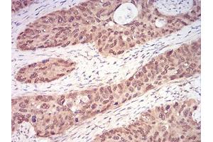 Immunohistochemistry (IHC) image for anti-RAN, Member RAS Oncogene Family (RAN) (AA 1-216) antibody (ABIN5542382)