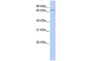 WB Suggested Anti-ALOX15B Antibody Titration:  0. (ALOX15B 抗体  (Middle Region))