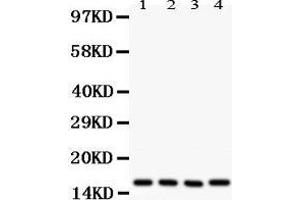 Western Blotting (WB) image for anti-Caveolin 2 (CAV2) (AA 1-162) antibody (ABIN3043749) (Caveolin 2 抗体  (AA 1-162))