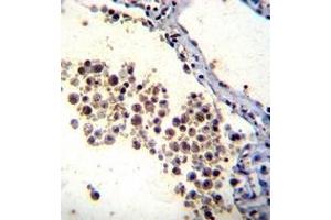 Formalin fixed and paraffin embedded human lung tissue reacted with DOK3 Antibody (C-term) followed by peroxidase conjugation of the secondary antibody and DAB staining. (DOK3 抗体  (C-Term))