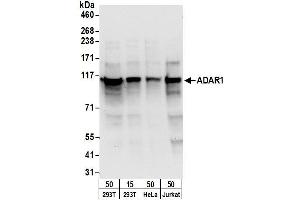 Western Blotting (WB) image for anti-Adenosine Deaminase, RNA-Specific (ADAR) (AA 950-1000) antibody (ABIN7454981)