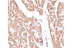 Immunohistochemistry (Paraffin-embedded Sections) (IHC (p)) image for anti-Kinesin Family Member 14 (KIF14) antibody (ABIN7255237)