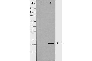 Western blot analysis of Hela whole cell lysates, using CBX5 Antibody. (CBX5 抗体  (Internal Region))