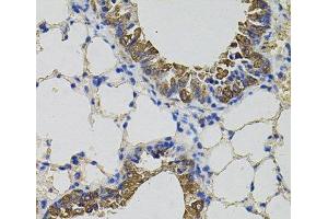Immunohistochemistry of paraffin-embedded Mouse lung using CKAP4 Polyclonal Antibody (CKAP4 抗体)