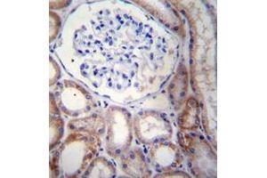 Immunohistochemistry (Paraffin-embedded Sections) (IHC (p)) image for anti-StAR-Related Lipid Transfer (START) Domain Containing 5 (STARD5) (AA 33-63), (N-Term) antibody (ABIN954973)