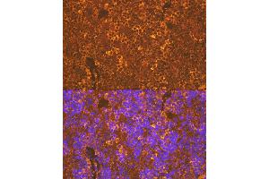 Immunofluorescence analysis of rat spleen using CXCR5 Rabbit mAb (ABIN7266321) at dilution of 1:100 (40x lens). (CXCR5 抗体)
