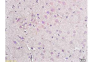 Formalin-fixed and paraffin embedded rat brain tissue labeled with Anti-NPY2R Polyclonal Antibody, Unconjugated (ABIN730063) at 1:200, followed by conjugation to the secondary antibody and DAB staining (NPY2R 抗体  (AA 301-381))