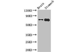 Western Blot Positive WB detected in: Mouse brain tissue, Mouse stomach tissue All lanes: EXD2 antibody at 2. (EXD2 抗体  (AA 137-245))