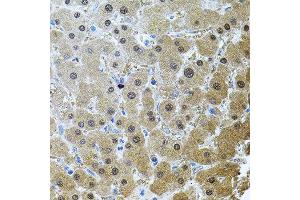 Immunohistochemistry of paraffin-embedded human liver injury using RNF166 antibody. (RNF166 抗体)