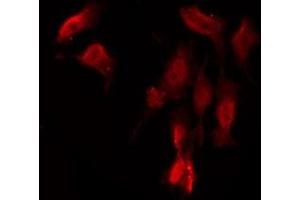 Immunofluorescence (fixed cells) (IF/ICC) image for anti-G Protein-Coupled Receptor, Family C, Group 6, Member A (GPRC6A) (Internal Region) antibody (ABIN6258833)