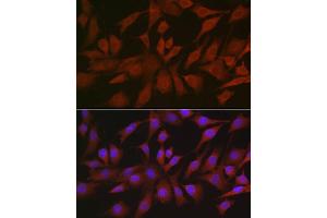 Immunofluorescence (IF) image for anti-Eukaryotic Translation Initiation Factor 4E Nuclear Import Factor 1 (EIF4ENIF1) (AA 150-250) antibody (ABIN7267051)