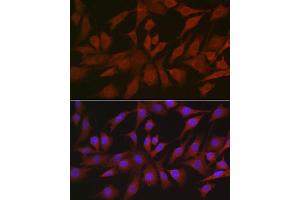 Immunofluorescence analysis of NIH/3T3 cells using EIF4ENIF1 Rabbit pAb (ABIN7267051) at dilution of 1:100 (40x lens). (EIF4ENIF1 抗体  (AA 150-250))