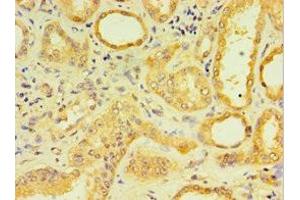 Immunohistochemistry of paraffin-embedded human kidney tissue using ABIN7158861 at dilution of 1:100 (DCP2 抗体  (AA 1-240))