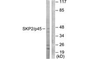 Western blot analysis of extracts from 293 cells, using SKP2/p45 Antibody. (SKP2 抗体  (AA 366-415))