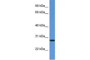 WB Suggested Anti-EDN3 Antibody Titration: 1. (Endothelin 3 抗体  (C-Term))