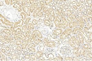 Immunohistochemical analysis of paraffin-embedded Human kidney section using Pink1 A. (BAP1 抗体  (AA 36-66))