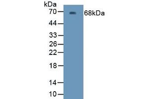 Detection of Recombinant Kim1, Human using Polyclonal Antibody to Kidney Injury Molecule 1 (Kim1) (HAVCR1 抗体  (AA 21-293))