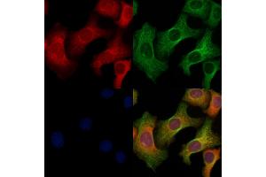 ABIN6264702 and ABIN6269113 staining Hela cells by IF/ICC.