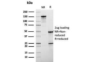 SDS-PAGE Analysis Purified HER-2 Mouse Monoclonal Antibody (ERBB2/3078). (ErbB2/Her2 抗体  (AA 311-462))