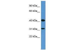 WB Suggested Anti-OR2W1 Antibody Titration: 0. (OR2W1 抗体  (C-Term))