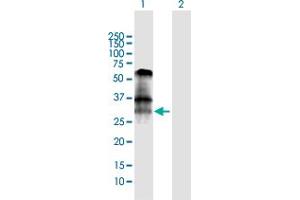 Western Blot analysis of BNIP3 expression in transfected 293T cell line by BNIP3 MaxPab polyclonal antibody. (BNIP3 抗体  (AA 1-194))