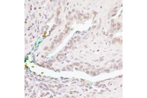 Immunohistochemistry (IHC) image for anti-B-Cell CLL/lymphoma 11B (Zinc Finger Protein) (BCL11B) (C-Term) antibody (ABIN7454622)