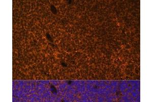 Immunofluorescence (IF) image for anti-Patched 1 (PTCH1) antibody (ABIN7255007)