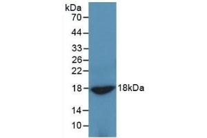 Detection of Recombinant ADP, Rat using Monoclonal Antibody to Adiponectin (ADPN) (ADIPOQ 抗体  (AA 111-244))