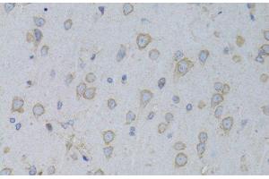 Immunohistochemistry of paraffin-embedded Rat brain using GARS Polyclonal Antibody at dilution of 1:100 (40x lens). (GARS 抗体)