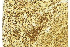 ABIN6269395 at 1/100 staining Mouse spleen tissue by IHC-P. (FANCD2 抗体  (N-Term))