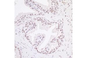 Immunohistochemistry (IHC) image for anti-MYC-Associated Zinc Finger Protein (Purine-Binding Transcription Factor) (MAZ) (AA 427-477) antibody (ABIN7454769) (MAZ 抗体  (AA 427-477))